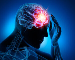 ¿Cómo puede ayudar Norden Leacox Accident & Injury Law con un reclamo por lesión cerebral en Orlando, FL? 