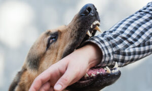 Why Choose Norden Leacox Accident & Injury Law for Help After a Dog Bite in Titusville?